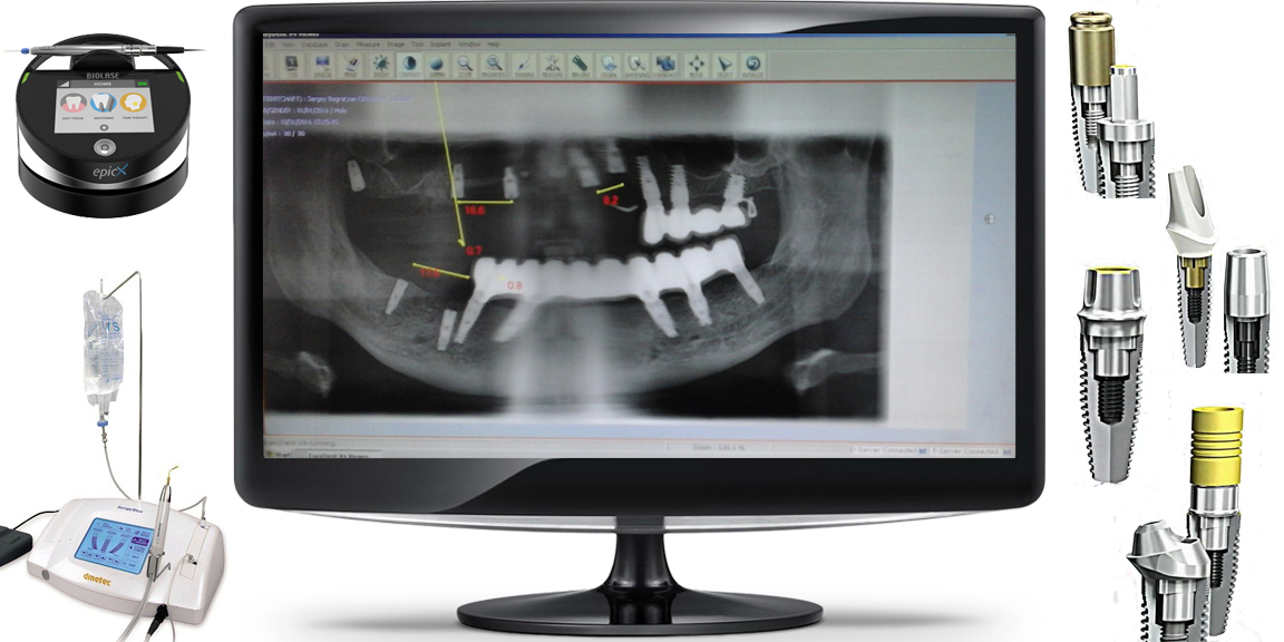 Our Dental Technology